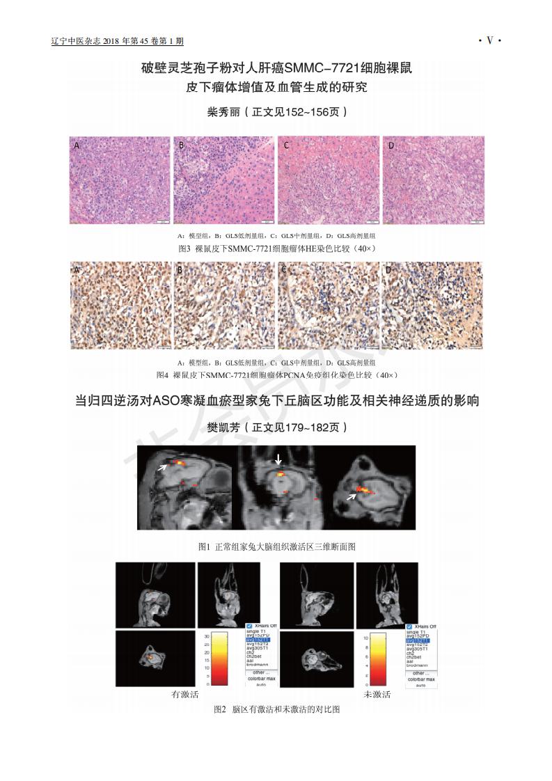 243 破壁华体online(中国)孢子粉对人肝癌SMMC-7721细胞裸鼠皮下瘤体增殖及血管生成的研究_04.jpg
