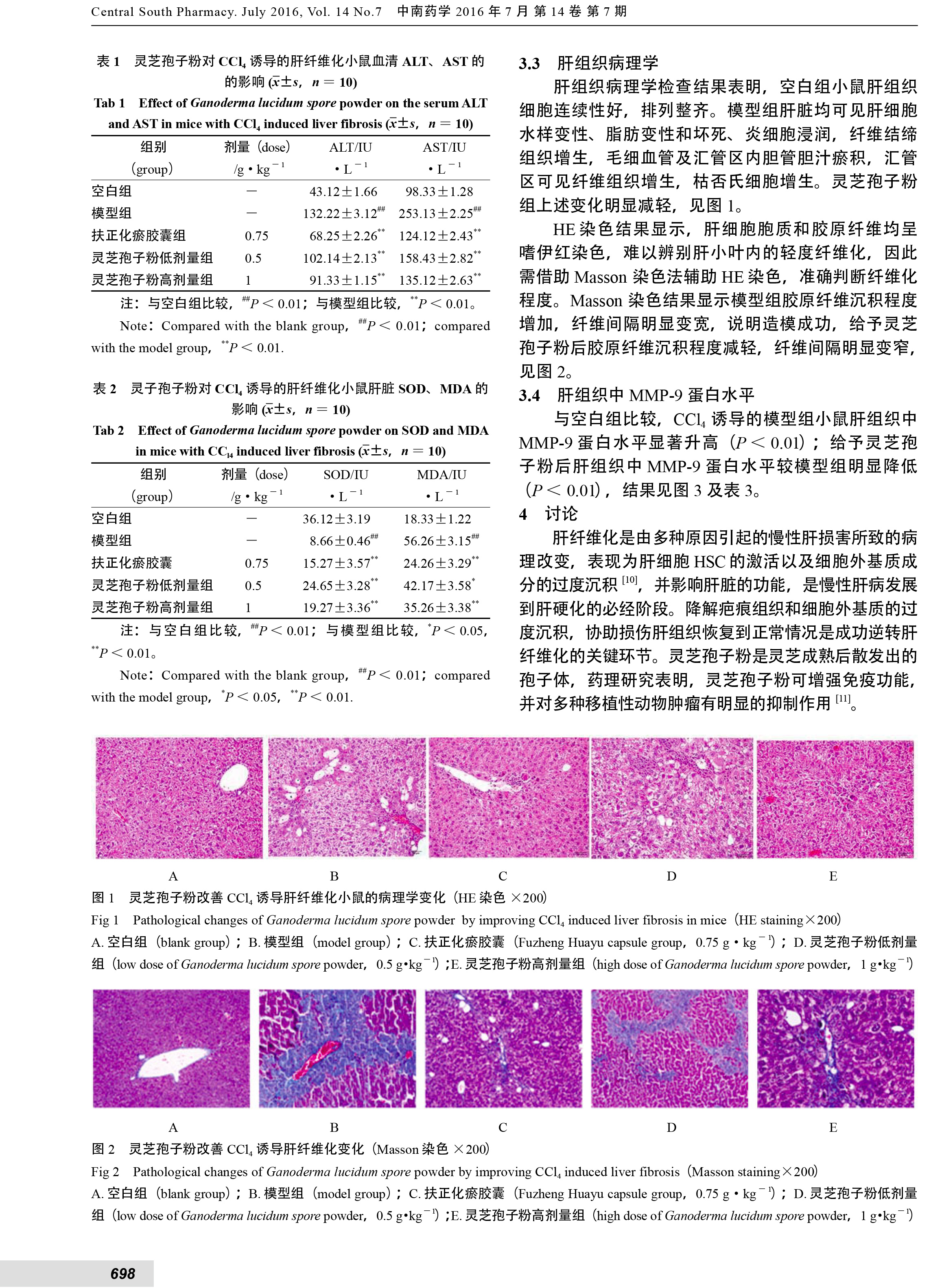 221 华体online(中国)孢子粉保护CCl_4引起的小鼠肝纤维化损伤的实验研究-3.jpg